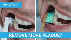 Electric Toothbrush to Remove Plaque