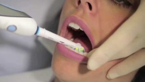 How to Angle Electric Toothbrush
