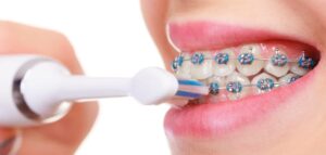 Can You Use an Electric Toothbrush With Braces