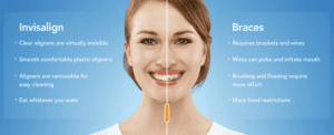Can You Use an Electric Toothbrush With Invisalign