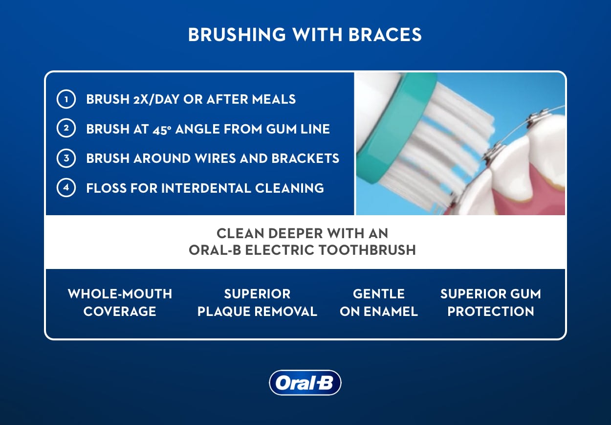 how-to-brush-your-teeth-with-braces-electric-toothbrush