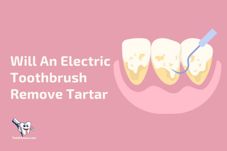 Will An Electric Toothbrush Remove Tartar