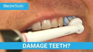 Do Electric Toothbrushes Damage Enamel