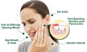 Can Wisdom Tooth Pain Radiate to Other Teeth