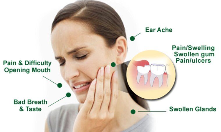 Can Wisdom Tooth Pain Radiate