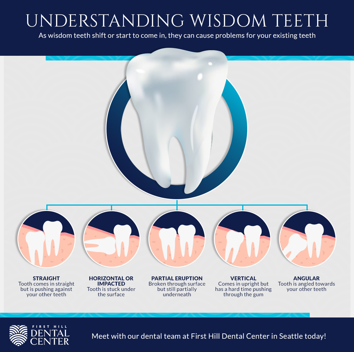 can-a-broken-wisdom-tooth-cause-headaches