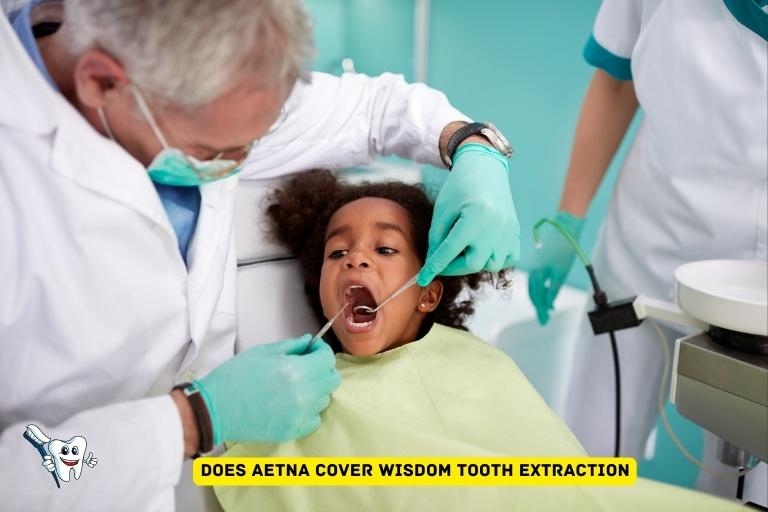 Does Aetna Cover Wisdom Tooth Extraction