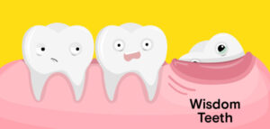 Is It Possible to Have Only One Wisdom Tooth