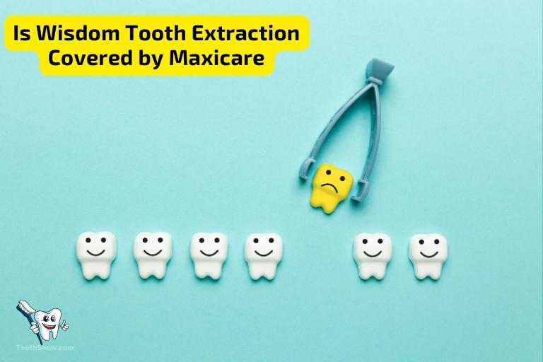 Is Wisdom Tooth Extraction Covered by Maxicare
