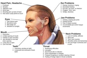 Tmj Problems After Wisdom Tooth Extraction