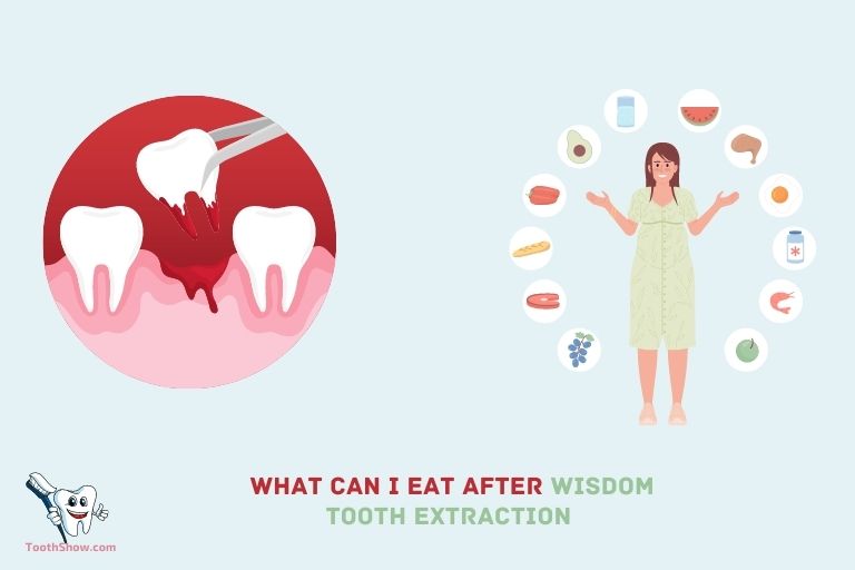 What Can I Eat After Wisdom Tooth Extraction Reddit