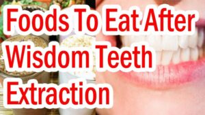 What Vitamins to Take After Wisdom Tooth Extraction