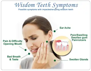 What are the Symptoms of Wisdom Tooth Pain