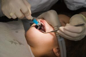 What to Do to Prepare for Wisdom Tooth Extraction