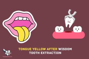 Why is My Tongue Yellow After Wisdom Tooth Extraction