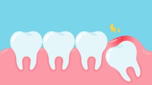 Does Listerine Help Wisdom Tooth Pain