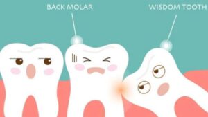 How to See Wisdom Tooth