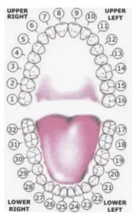 Is Tooth 18 a Wisdom Tooth