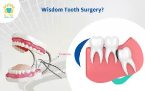 Is Wisdom Tooth Removal Considered Surgery