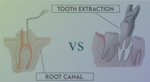 Root Canal Vs Wisdom Tooth Pain