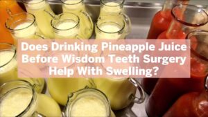 What to Drink before Wisdom Tooth Extraction