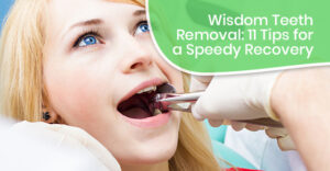 Wisdom Tooth Removal Tips