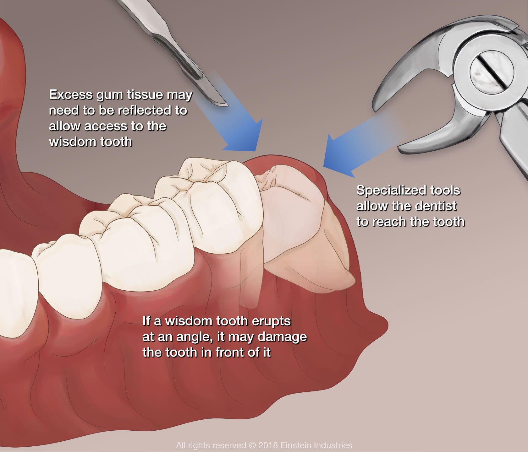 different-types-of-tooth-pain-and-what-they-mean