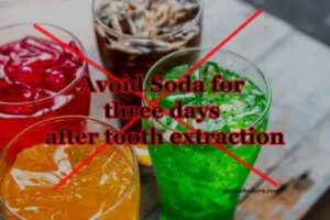 Can You Drink Soda After Wisdom Tooth Removal