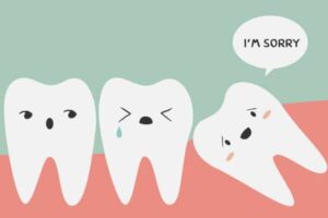Can a Wisdom Tooth Fall Out