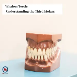 Is the Third Molar the Wisdom Tooth