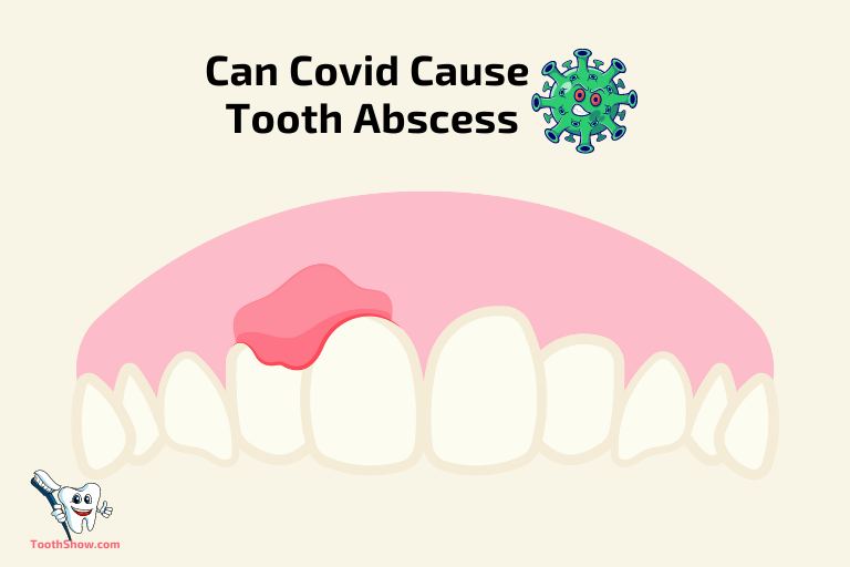 Can Covid Cause Tooth Abscess