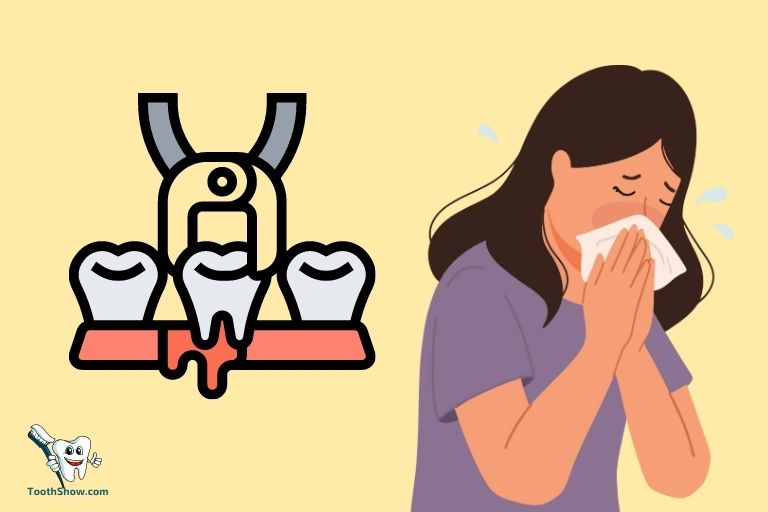 Can I Sneeze After Wisdom Tooth Extraction