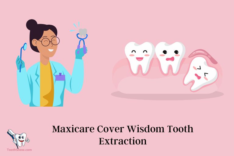 Does Maxicare Cover Wisdom Tooth Extraction Yes