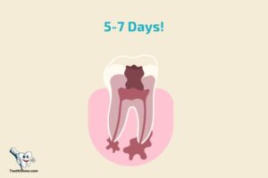 How Long Does Tooth Abscess Swelling Last? 5-7 Days!