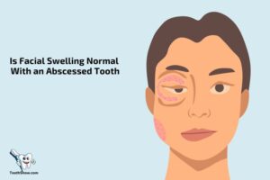 Is Facial Swelling Normal With an Abscessed Tooth? Yes!
