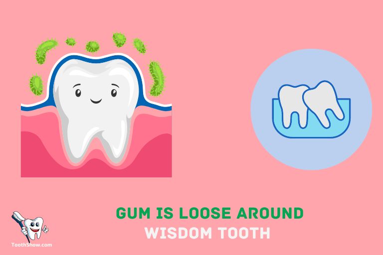 My Gum Is Loose Around Wisdom Tooth