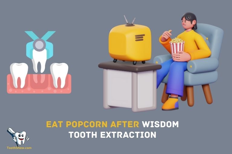 When Can I Eat Popcorn After Wisdom Tooth Extraction