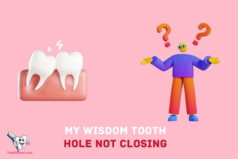 Why Is My Wisdom Tooth Hole Not Closing