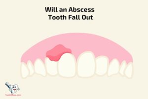 Will an Abscess Tooth Fall Out? Yes!
