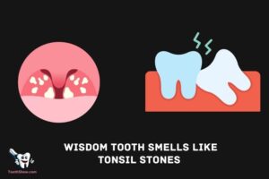 Wisdom Tooth Smells Like Tonsil Stones Reddit