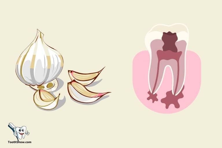 does garlic kill abscess tooth