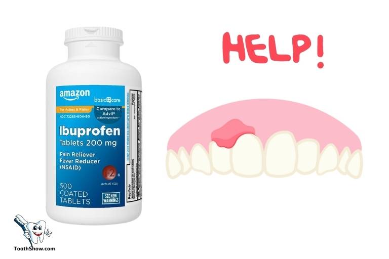does ibuprofen help tooth abscess