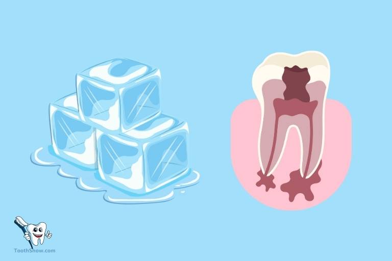 does ice help tooth abscess