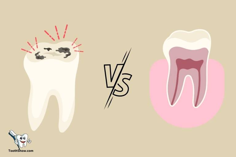 gum abscess vs tooth abscess
