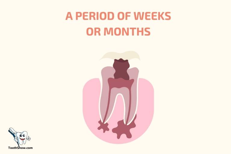 how long can an abscess tooth go untreated