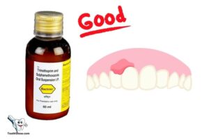 Is Bactrim Good for Abscess Tooth? Yes!