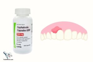 Is Cephalexin Good for Abscess Tooth? ? Find Out Now