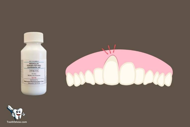 what antibiotics for tooth abscess