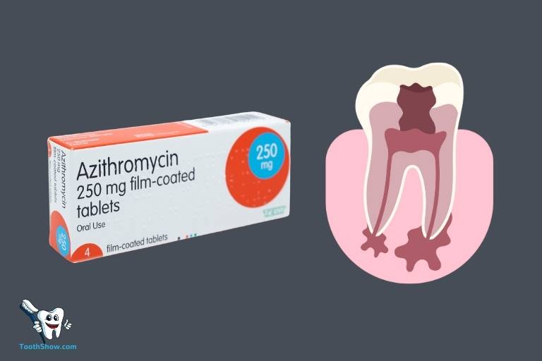 will azithromycin treat abscessed tooth