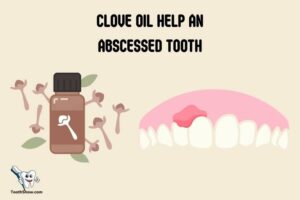 Will Clove Oil Help an Abscessed Tooth? Yes!